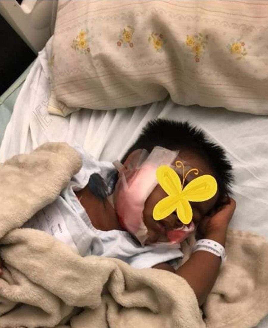 Mother saves child, 3, from dog Trinidad Guardian