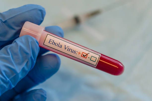 Gonzales calls for Ebola preparedness plan